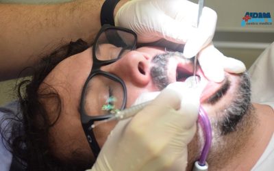 Sbiancamento dentale: è davvero sicuro per i tuoi denti?