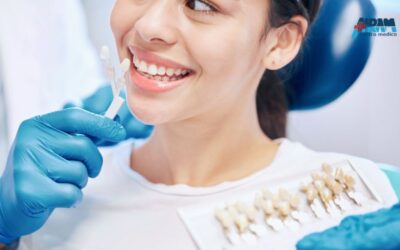 Faccette estetiche dentali: il trattamento per un sorriso armonioso e naturale