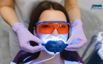 Sbiancamento dentale professionale vs fai-da-te: quale scegliere