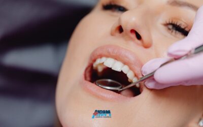 Igiene orale professionale: perché fare la pulizia dei denti
