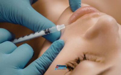 Quanto dura il filler labbra? Tempi, ritocco e mantenimento