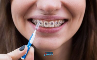 Scovolino denti: come usarlo correttamente e quando serve davvero