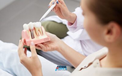 Implantologia dentale: le 10 domande più frequenti dei pazienti